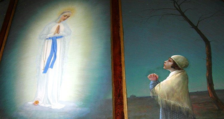 APARIÇÕES DIVINAS AFINAL SÃO EPILEPSIA