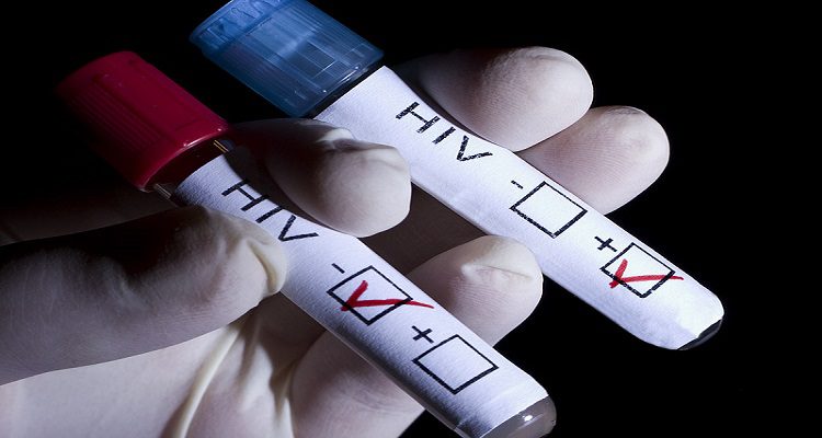 HIV: MILHÕES NOVOS INFECTADOS